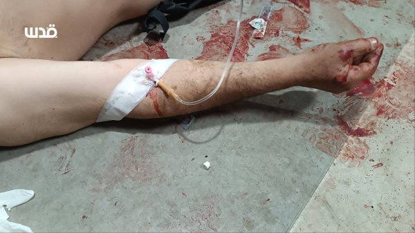 مجزرة دَوّار النَابلْسِي | موسوعة القرى الفلسطينية