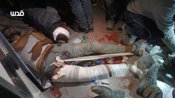 مجزرة دَوّار النَابلْسِي | موسوعة القرى الفلسطينية